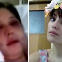 La joven atacada por el anestesista: «los vecinos me salvaron de la muerte»